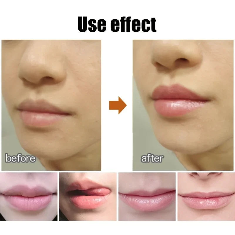 Schattige Balvormige Lippenbalsem - Voedende, Verzachtende en Langdurige Lippenplumper met Een Plakvrije Cup om Bevriezingsscheuren te Voorkomen
