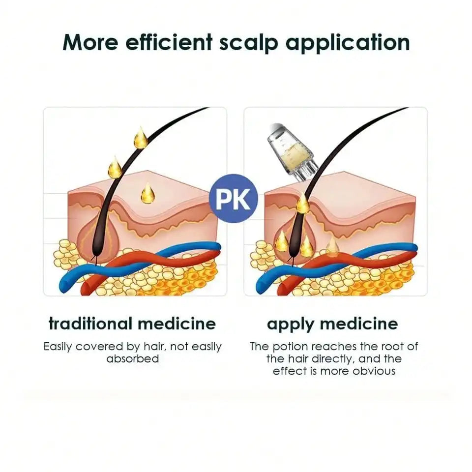 Hexagonale Kop Scalp Applicator: Ultieme Haarhergroei & Stylenoplossing met Olie Rollerbal voor Ontspanning en Massage