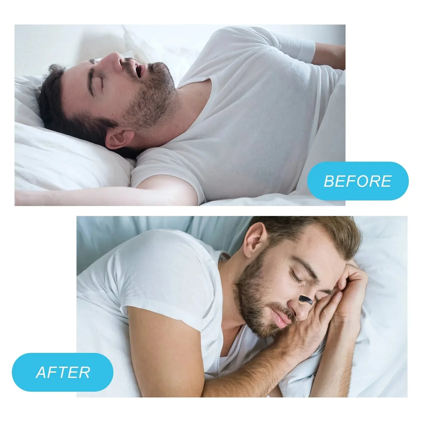 Ultimate Anti-Snoringsneusclipkit - Verbeter Uw Ademhaling en Slaapkwaliteit met Magnetische Dilatators voor Sport en Rustige Nachten