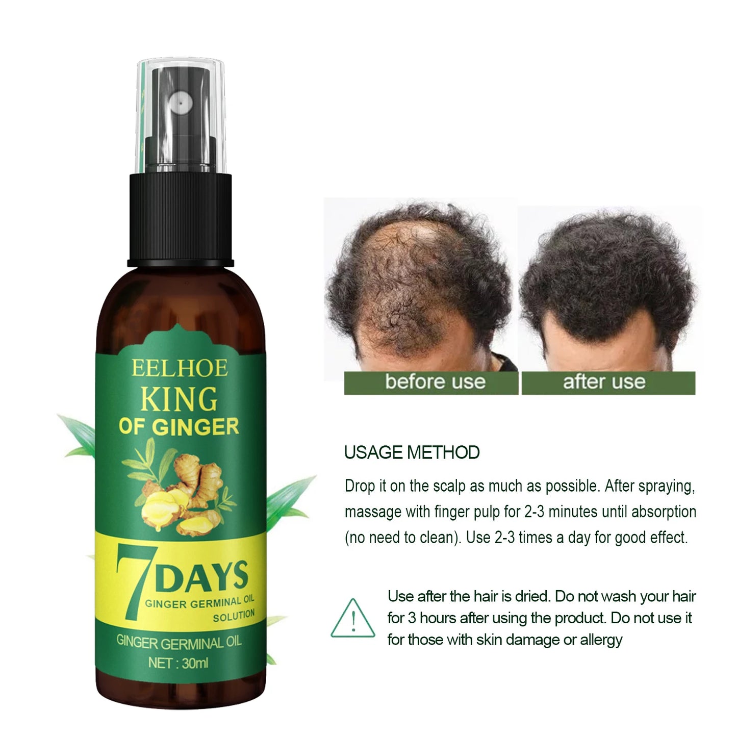 Revitaliseer je haar met Ginger Care Groei Essentie: Voedende Spray voor Hoofdmassage en Ultieme Haarherstel!