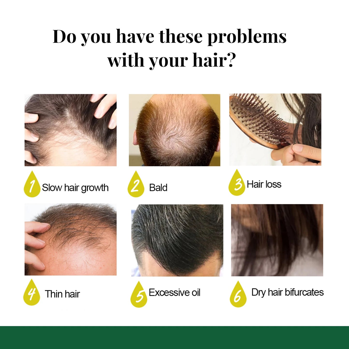 Revitaliseer je haar met Ginger Care Groei Essentie: Voedende Spray voor Hoofdmassage en Ultieme Haarherstel!