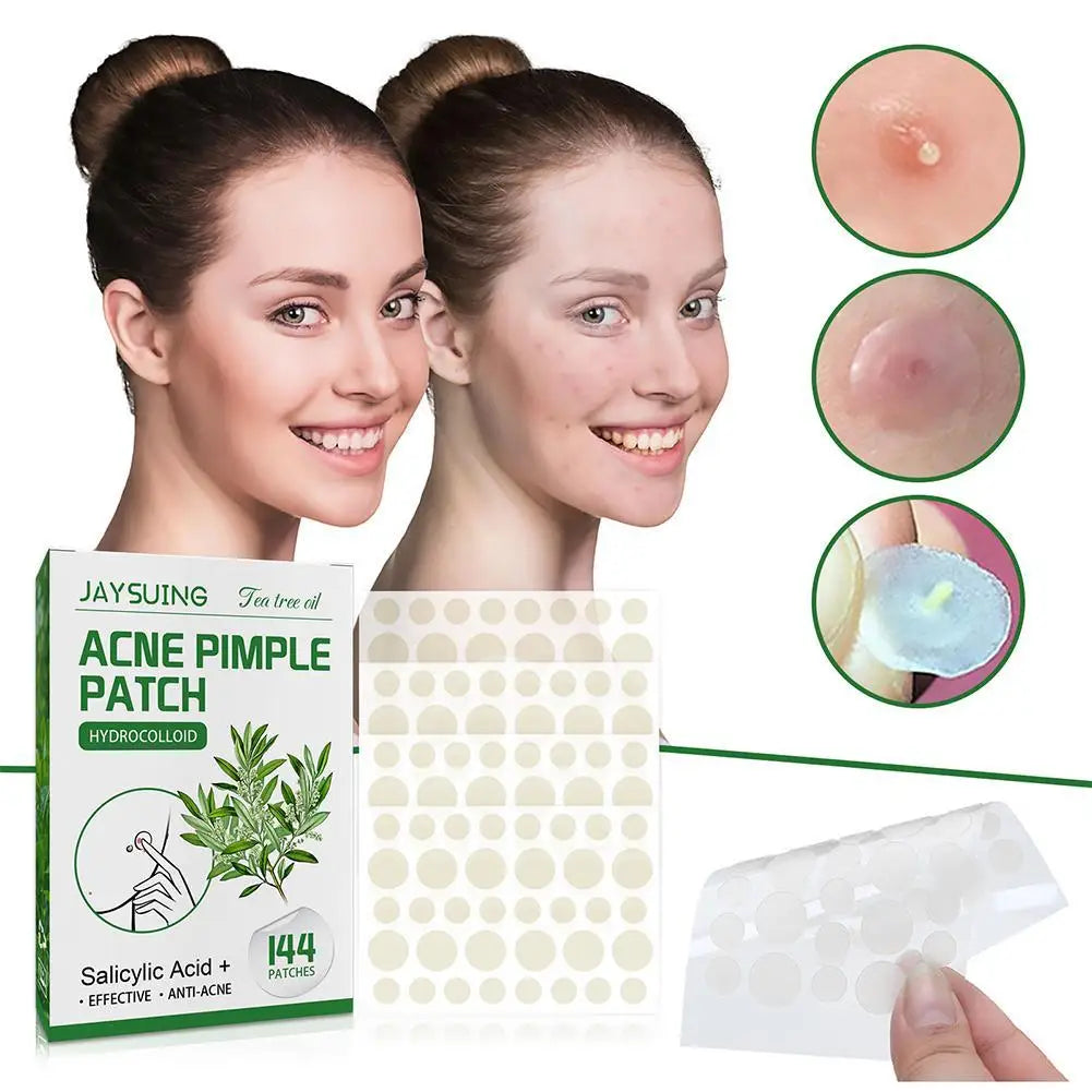 144 Heldere Acne Puistpleisters met Hydrocolloïd, Versterkt met Salicylzuur en Tea Tree Olie om Ontstoken Uitbarstingen te Kalmeren en Witte Punkten te Verbeteren