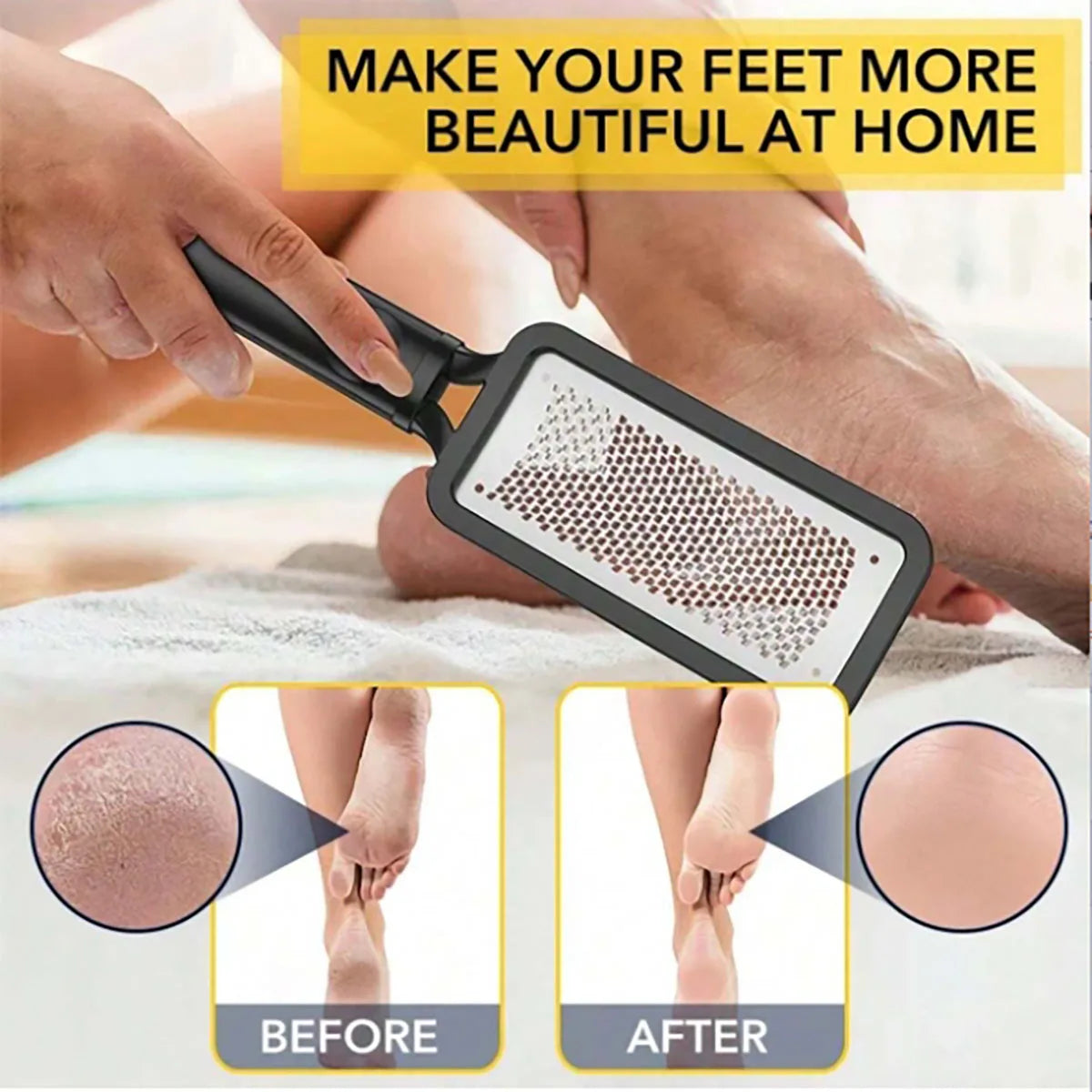 Ultimate Dubbelzijdige Voetvijl - Professionele Rasp voor Moeiteloze Hakverzorging en Dode Huidverwijdering - Essentieel Pedicure Gereedschap