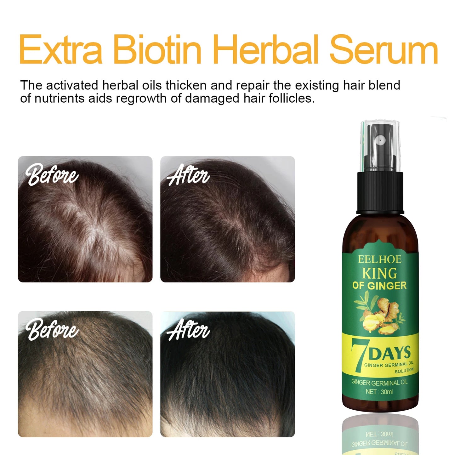 Revitaliseer je haar met Ginger Care Groei Essentie: Voedende Spray voor Hoofdmassage en Ultieme Haarherstel!