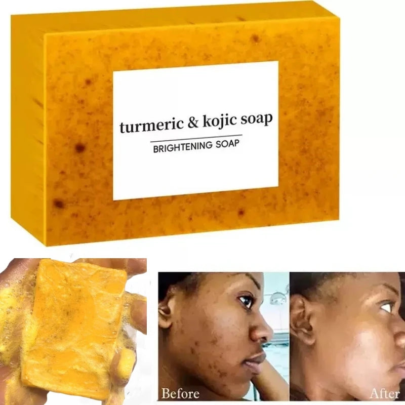 Revitaliseer je huid met Citroen Curcuma Kojic Acid Zeep - Bereik een Heldere, Evenwichte Toon en Gladde, Stralende Teint terwijl je Diep Reinigt en Olie Onder Controle Houdt voor Donkere Huidverzorging!