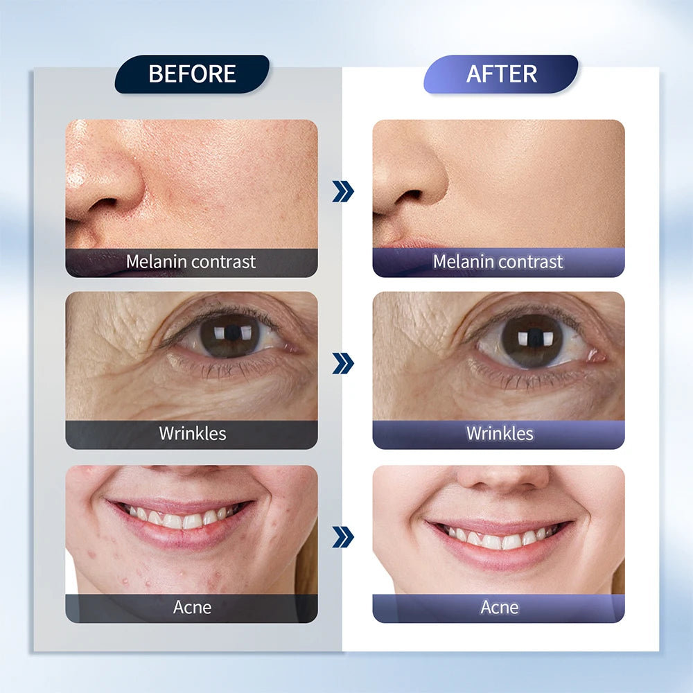 Revitaliseer uw huid met de ForeverLily LED Gezichtsmasker PDT-machine – 7 Kleur Photon Therapie voor ultieme spa-kwaliteit verjonging en verfrissende nano-nevel!