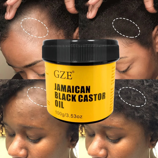 GZE JAMAICAN Pure Koudgeperste Zwarte Ricinusolie voor Weelderige Haargroei, Diepe Huid Hydratatie en Scalp Vitaliteit - Ontgrendel het Volledige Potentieel van je Haar!