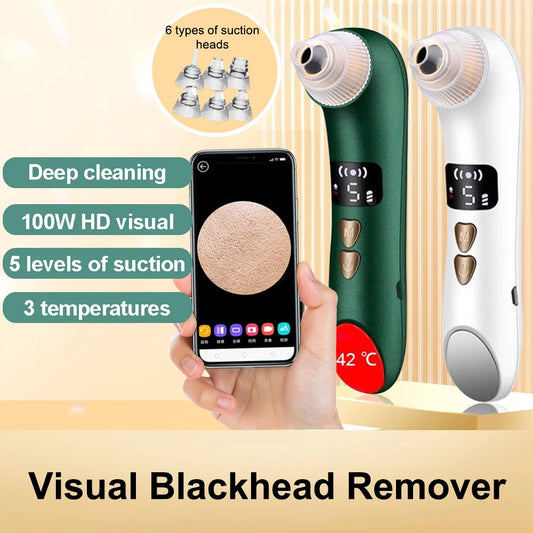 Geavanceerde Gezichts Blackhead en Acne Verwijderaar Machine – Verhitte Elektrische Extractor voor Diepe Reiniging en Panneloze Huid