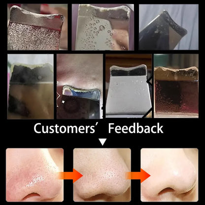 Verfris je huid met de Ultrasone Pore Cleansing Spatula – Effectieve Mee-eter Verwijderaar en Vibrerende Massageschraper voor Diepe Reiniging en Zorg!