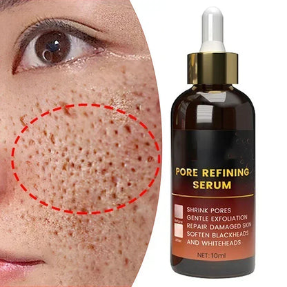 Revitaliseer je huid: Pore-reducerend gezichtserum voor het controleren van mee-eters en acne - Voedende, hydraterende en verstrakkende herstelessence
