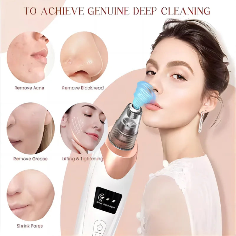 Geavanceerde Zwarte Punt Verwijderaar Vacuüm - Ultieme Porie Reiniger voor Gezicht en Neus - Elektrische Acne Extractie Kit voor Perfecte Huid
