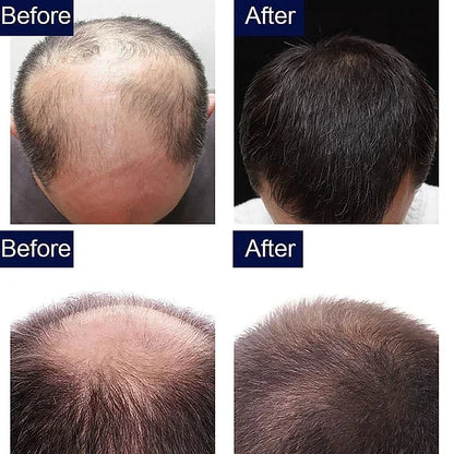 Revitaliseer je haar met onze 7-dagen gembergroei-elixer: anti-haaruitval conditioneringsbehandeling en voedend hoofdhuidserum!