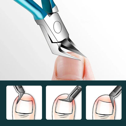 Premium Roestvrijstalen Nagelknipper en Cutille Nippers voor Perfecte Pedicure - Ingroeiende Teennagels Schaar voor Moeiteloze Dode Huidverwijdering