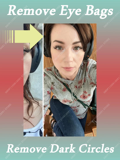 Revitaliseer je ogen: Luxe anti-verouderingscrème om rimpels, opgezwollen tassen en donkere kringen te bannen - Hydraterende, verhelderende huidverzorging!