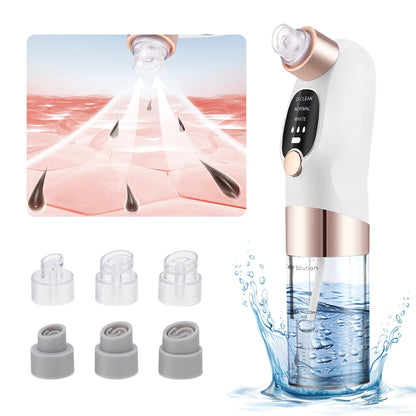 Ultimate Elektrische Bubbels Zwarte Punt Vacuum & Porie Cleaner – Acne & Puist Extractor voor Perfecte Huid!