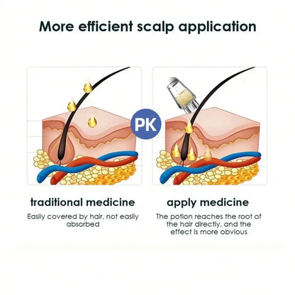 Hexagonale Kop Scalp Applicator: Ultieme Haarhergroei & Stylenoplossing met Olie Rollerbal voor Ontspanning en Massage