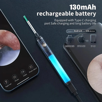 Premium Slimme Visuele Oorwasverwijderaar Kit: 1080P HD Otoscope Camera, 8-delige Oorreiniger Set en 6 LED Lichten voor Effectieve Oorverzorging