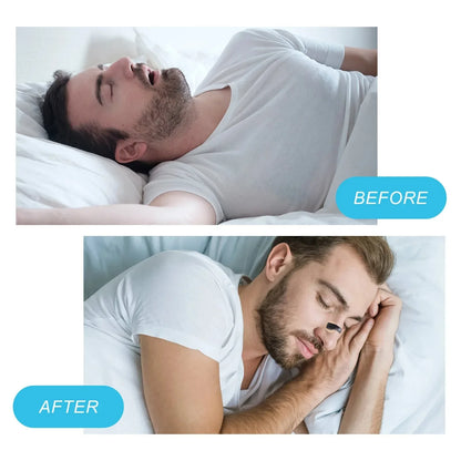 Ultimate Anti-Snoringsneusclipkit - Verbeter Uw Ademhaling en Slaapkwaliteit met Magnetische Dilatators voor Sport en Rustige Nachten