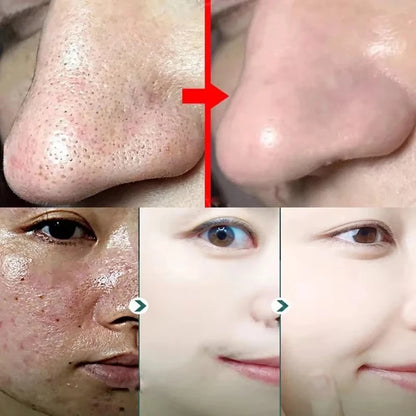 revitaliseer je huid met onze groene thee zwarteheads verwijderende vaste masker - richt je op acne, vlekken en minimaliseer poriën!