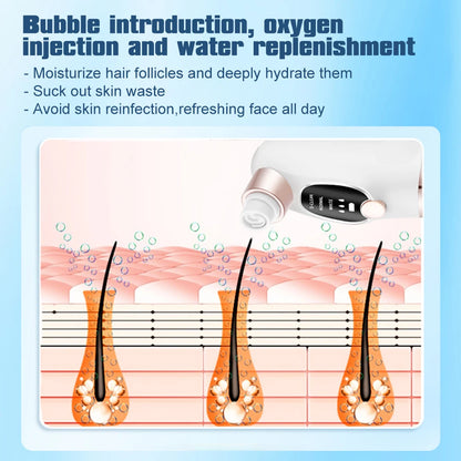 Ultimate Elektrische Bubbels Zwarte Punt Vacuum & Porie Cleaner – Acne & Puist Extractor voor Perfecte Huid!