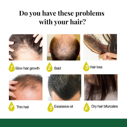 Revitaliseer je haar met Ginger Care Groei Essentie: Voedende Spray voor Hoofdmassage en Ultieme Haarherstel!