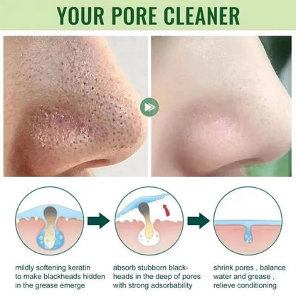 revitaliseer je huid met onze groene thee zwarteheads verwijderende vaste masker - richt je op acne, vlekken en minimaliseer poriën!