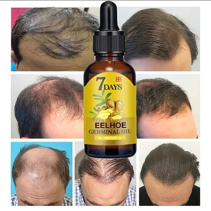Revitaliseer je haar met onze 7-dagen gembergroei-elixer: anti-haaruitval conditioneringsbehandeling en voedend hoofdhuidserum!