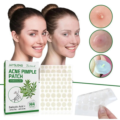 144 Heldere Acne Puistpleisters met Hydrocolloïd, Versterkt met Salicylzuur en Tea Tree Olie om Ontstoken Uitbarstingen te Kalmeren en Witte Punkten te Verbeteren