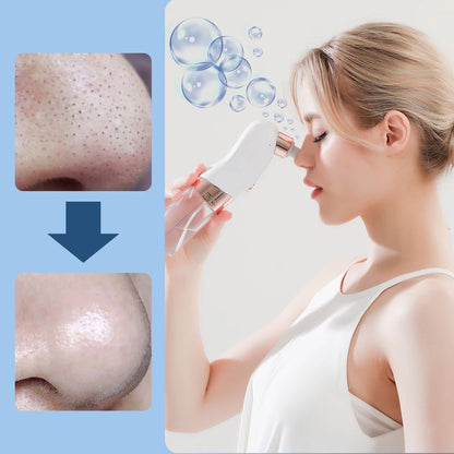Ultimate Elektrische Bubbels Zwarte Punt Vacuum & Porie Cleaner – Acne & Puist Extractor voor Perfecte Huid!