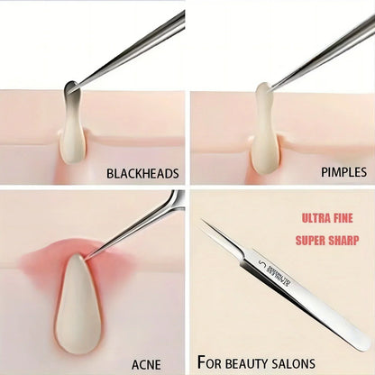 1 Verpakking Precisie Nr. 5 Cellulaire Acne- en Mee-eterpincet - Essentiële Schoonheidstools voor Perfecte Huidverzorging