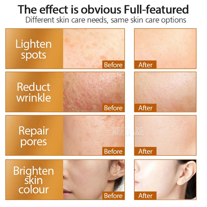 Revolutionaire ZGTS Derma Roller met 192 Micronaalden - 0,25 mm voor Gezicht en Lichaam Mesotherapie, Perfect voor het Verminderen van Littekens en Striae!