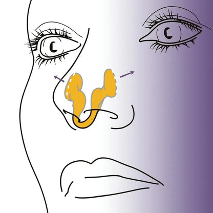 Siliconen Neusclip tegen Snurken – Voor Betere Slaap & Ademhaling